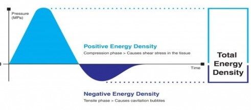 what is shock wave