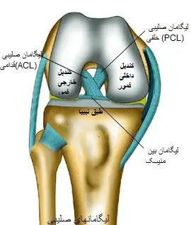 تشخیص پارگی لیگامان صلیبی قدامی زانو