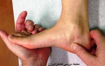 درمان عصب مچ پا