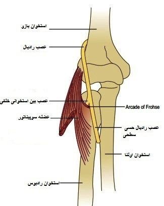 عصب رادیال در ساعد