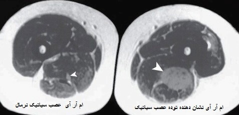 نروپاتی سیاتیک