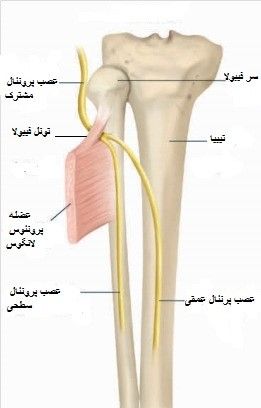 گیر افتادن عصب در ناحیه تونل فیبولا